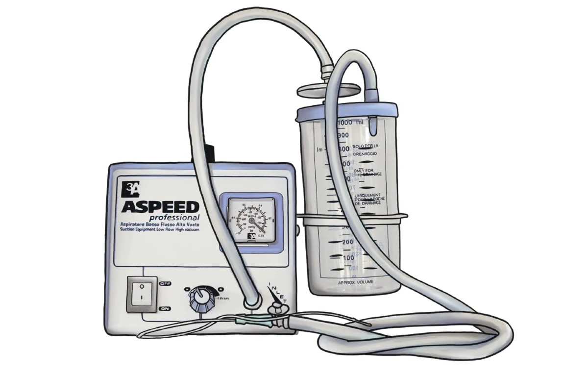 Aspeed suction pump